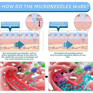 Alisanda NIDDK-Tirzepatide Nano Microneedle Patch