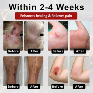 ALISANDA® GlucoseGuard Skin Rescue Cream