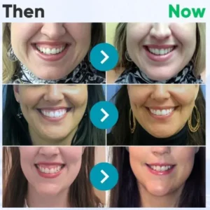 Alisanda® VioGloss Bee Venom Dental Therapy Oral Power