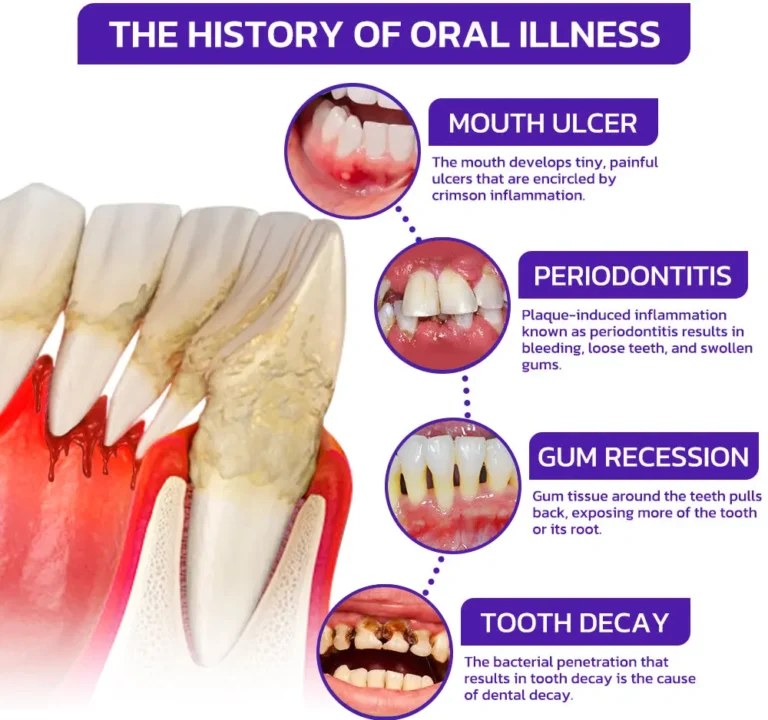 Alisanda® VioGloss Bee Venom Dental Therapy Oral Power