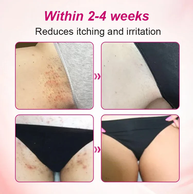 Alisanda Feminine Care Gel