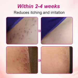 Alisanda Feminine Care Gel