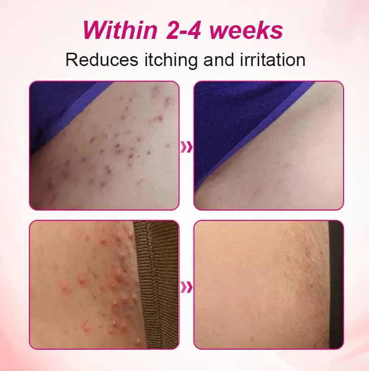 Alisanda Feminine Care Gel