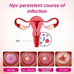 Alisanda Feminine Care Gel