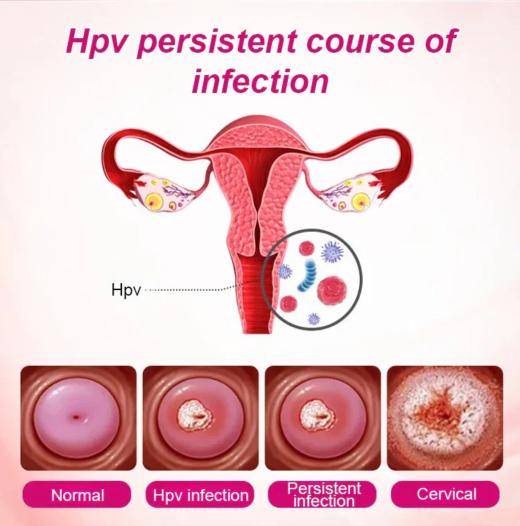 Alisanda Feminine Care Gel