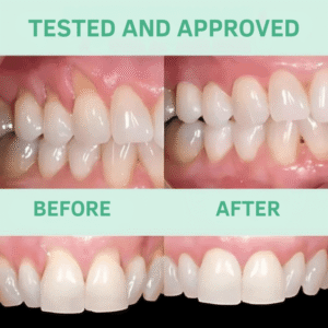 Elycura™ | Get Brighter Smiles & Restore Receding Gums in 93% of Cases Within 4 Days! 9 Elycura™ | Get Brighter Smiles & Restore Receding Gums in 93% of Cases Within 4 Days!