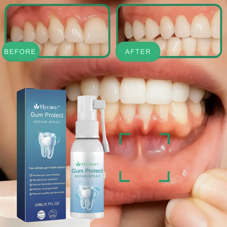 Elycura™ | Get Brighter Smiles & Restore Receding Gums in 93% of Cases Within 4 Days! 1 Elycura™ | Get Brighter Smiles & Restore Receding Gums in 93% of Cases Within 4 Days!