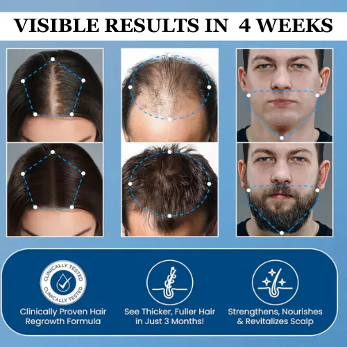 Alisanda® Hair Growth Roll on Serum 5 Alisanda® Hair Growth Roll on Serum