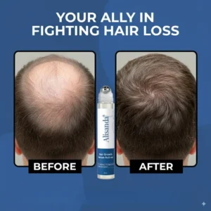 Alisanda® Hair Growth Roll on Serum 7 Alisanda® Hair Growth Roll on Serum