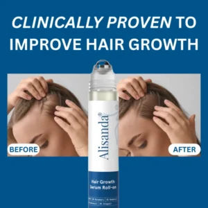 Alisanda® Hair Growth Roll on Serum 6 Alisanda® Hair Growth Roll on Serum
