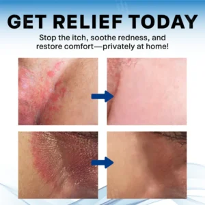 Alisanda® Scrotum Itchy Treatment Cream