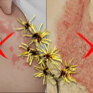 Alisanda® Jock Itch Relief Soap Bar.End the discomfort.