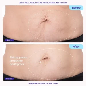 Alisanda™ Firming Belly Cream